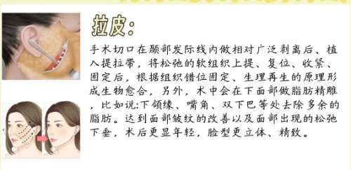 拉皮 拉皮