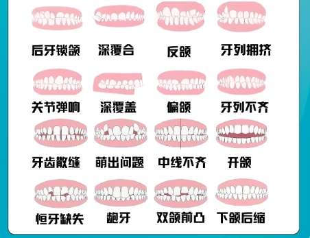 正颌