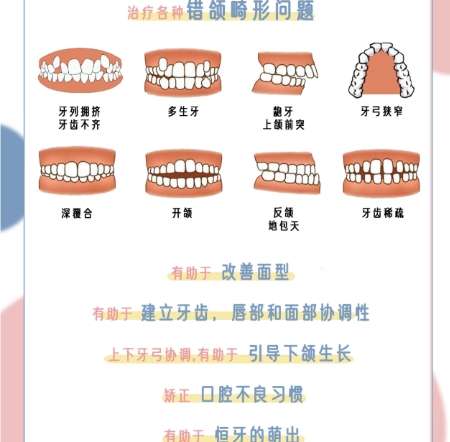 牙齿矫正