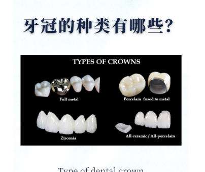 全瓷牙