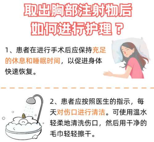 取乳房注射物 取乳房注射物