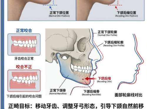 牙齿矫正4.jpg