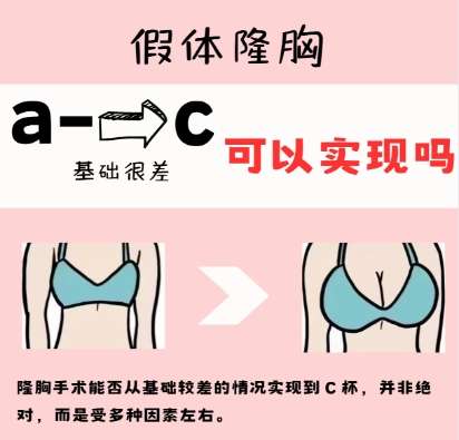隆胸