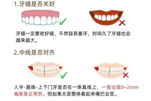 牙齿矫正1.jpg