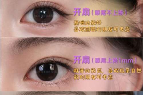 双眼皮   2.jpg