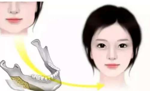 下颌角 下颌角
