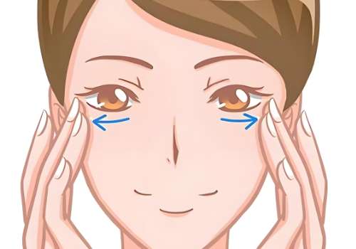 去眼袋4.jpg