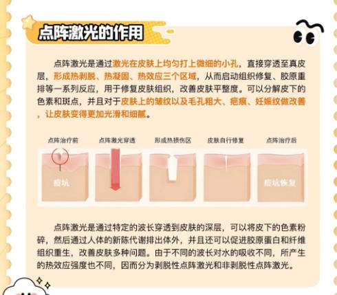 点阵激光4.jpg