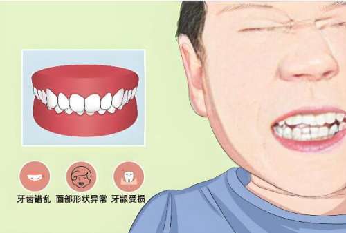 正畸9.jpg