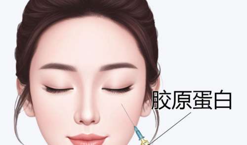 胶原蛋白