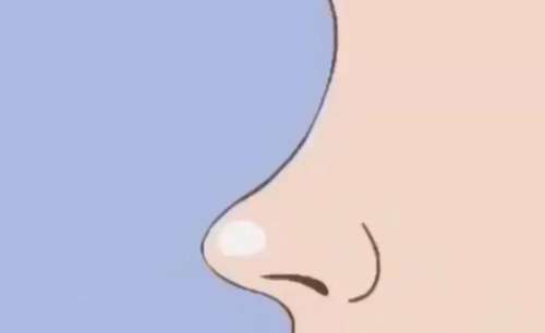 鼻修复 鼻修复