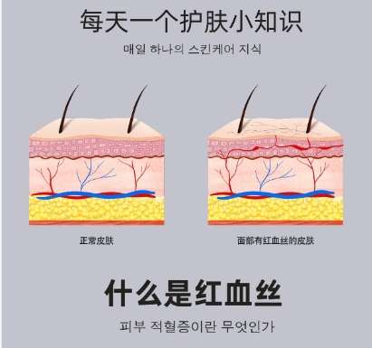 去红血丝