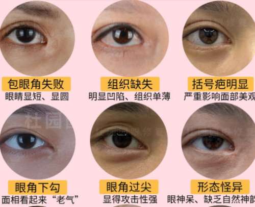 内眼角.jpg 内眼角.jpg