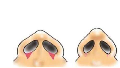 鼻