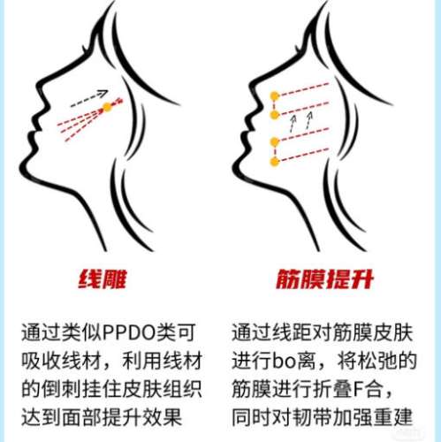 筋膜.jpg