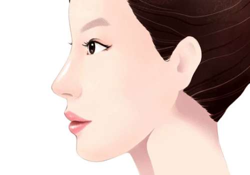 隆鼻7.jpg