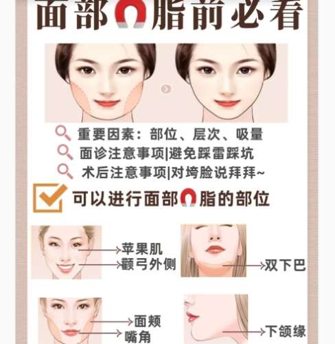 面吸