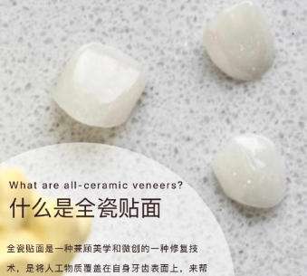 全瓷贴面1.jpg