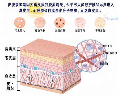 注射胶原蛋白