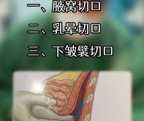 丰胸2.jpg