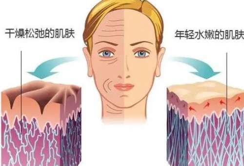 除皱 除皱