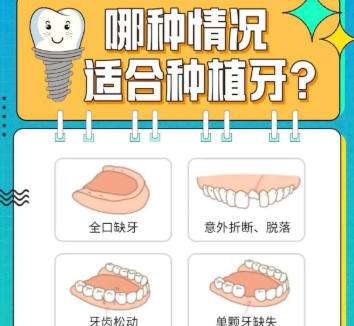 牙齿种植