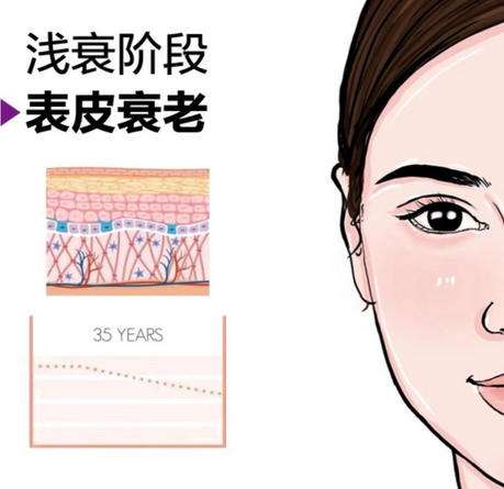 面部提升 面部提升
