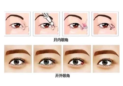 开眼角1.jpg