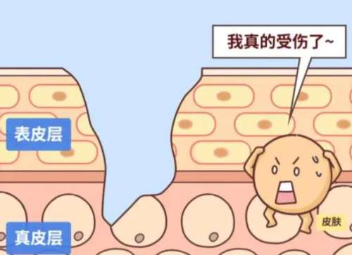 疤痕
