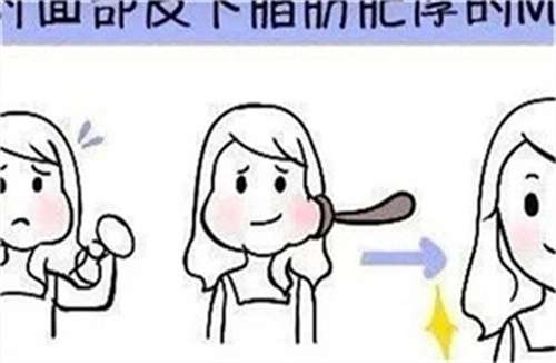 吸脂1.jpg