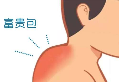 富贵包 富贵包