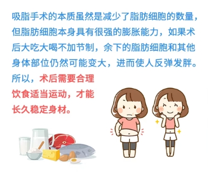 吸脂 吸脂