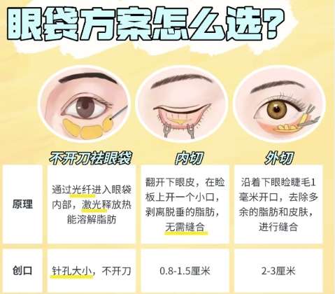 去眼袋