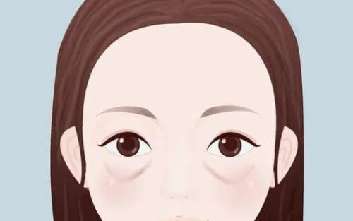 眼袋 眼袋