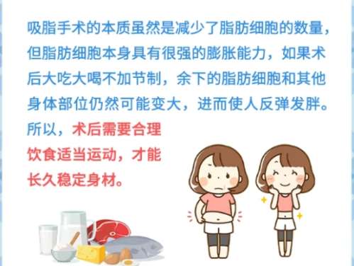 吸脂 吸脂