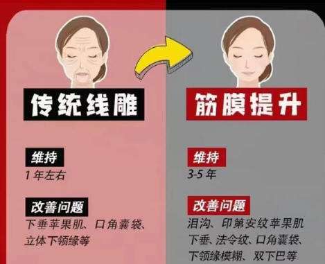 无痕筋膜.jpg
