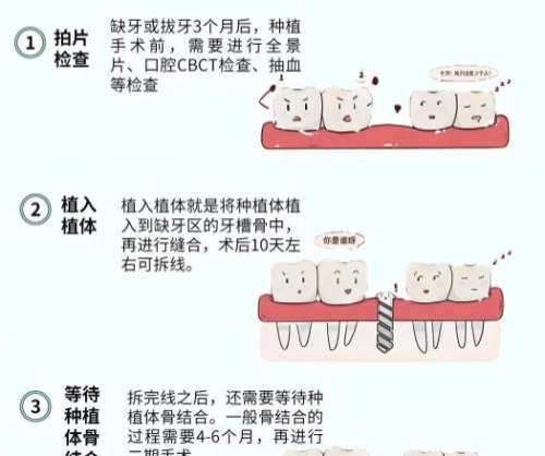 多少钱 多少钱