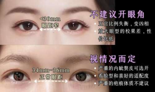 开眼角4.jpg 开眼角4.jpg