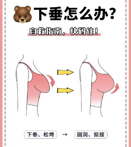 下垂 下垂