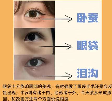去眼袋