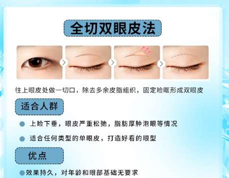 双眼皮