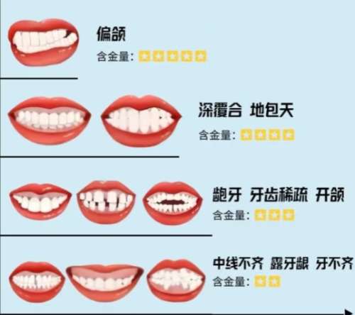 地包天矫正