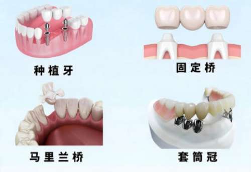 种牙2.jpg 种牙2.jpg