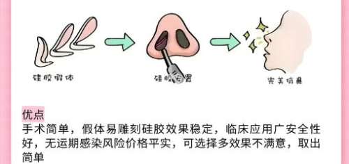 隆鼻