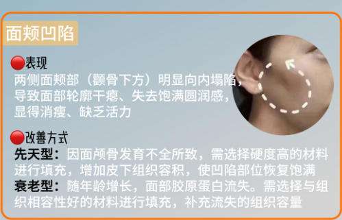 注射填充 .jpg 注射填充 .jpg