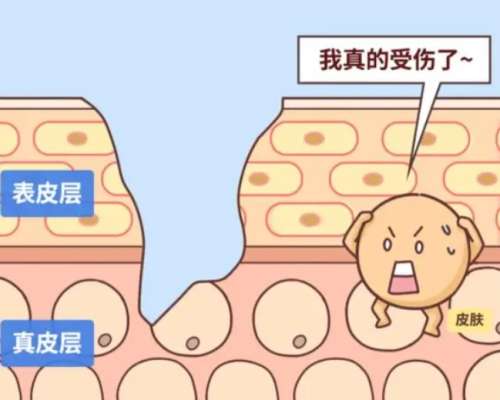 大腿疤痕动漫03.jpg 大腿疤痕动漫03.jpg