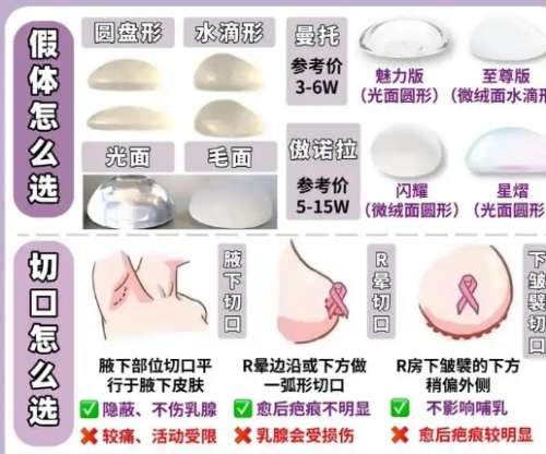 隆胸