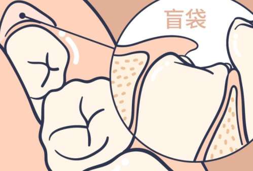 智齿dm02.jpg
