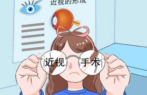 激光近视眼矫正.jpg