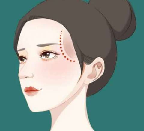 丰太阳穴